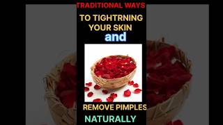 Remove acne and oily skin naturallyenhance skin naturallybenefits of Rose waternaturalcarebeauty [upl. by Quintie]