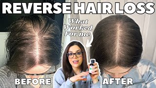 How I STOPPED MY HAIR LOSS  1 Thing That ReGrew My Hair [upl. by Ganiats]