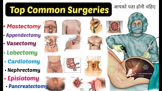 Top 15 Common Surgeries  You Should Know  mastectomy Appendectomy Lobectomyamp More [upl. by Yehs]