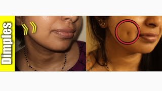 How to Naturally Create Dimples Permanently WITHOUT Surgery [upl. by Epillihp]