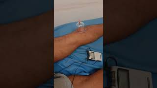 Sciatica pain physiotherapy treatment best physiotherapy treatment in Kolkata [upl. by Aliwt578]