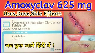 Amoxycillin and Potassium Clavulanate 625 mg Tablets IP Amoxyclav 625 mg Tablet Uses In Hindi [upl. by Elawalo]