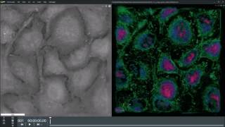 Lung cancer cells 100 confluency under 3D microscope [upl. by Fedak]