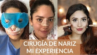 ME OPERÉ LA NARIZ   CIRUGÍA FUNCIONAL Y ESTÉTICA  MICH ECUADOR [upl. by Onilegna]