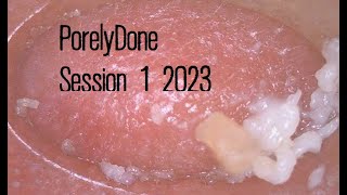 PorelyDone 2023week1 Pore Blackhead and Oil Vacuum Suction Removal [upl. by Nawaj]