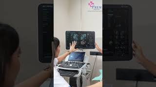 A Day in the Life of Our Radiology Department  BTS of XRays and Ultrasounds  Prem Hospital [upl. by Ahseim581]