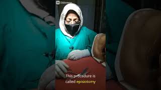 Episiotomy sciessor Part1 doctor delivery hospital nursingexperts pregnancy nursingstudents [upl. by Adnilreb]