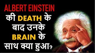 Albert Einstein की Death के बाद उनके Brain के साथ क्या हुआ The brain of Albert Einstein [upl. by Gerald]