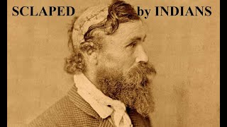 SCALPED  Santa Fe Trail Story of 13YearOld Robert McGee Survived 14 ArrowSpear Wounds [upl. by Gentes]