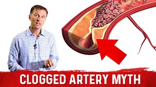 The Clogged Artery Myth – Dr Berg [upl. by Ethelred]