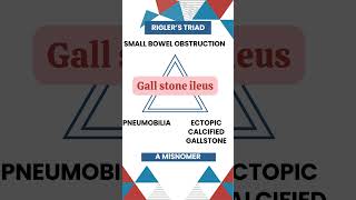 Riglers Triad Key Signs of Gallstone Ileus Explained gallbladderproblems MedicalEducation [upl. by Ennoitna]