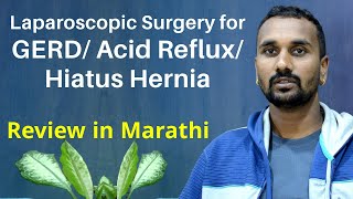 Longterm Acid refluxHiatus HerniaHeartburn treatment in Ahmedabad Patient Review In Marathi [upl. by Nerb]