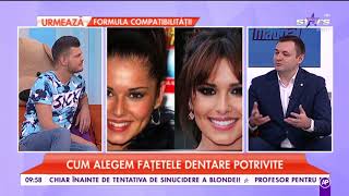 Fațetele dentare etapele procesului de fațetare Avantaje și dezavantaje în funcție de model [upl. by Ecinuahs]