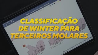 Classificação de Winter para terceiros molares [upl. by Refinnej361]