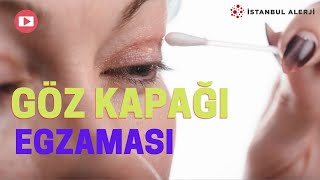 Göz Kapağı Egzaması  İstanbul Alerji  Prof Dr Ahmet Akçay [upl. by Elokkin868]