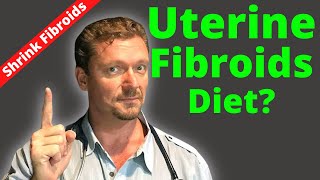 Shrink FIBROIDS Little Known Scientific Fix 2024 [upl. by Ifen658]