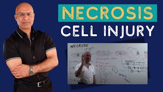 Necrosis Cell Injury  Apoptosis  General Pathology🦠 [upl. by Idel]