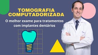 TOMOGRAFIA COMPUTADORIZADA  POR QUE É O MELHOR EXAME PARA IMPLANTES [upl. by Snook]