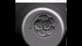 Blastocyst Video  Science at Boston IVF [upl. by Julian]