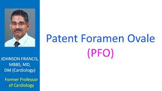 Patent foramen ovale PFO [upl. by Athena]