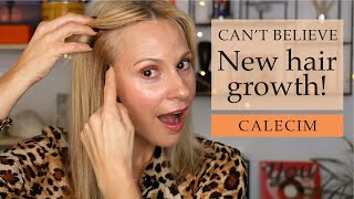 🤩 Calecim Stem Cell Hair Serum Review 🤩  Best Beauty Products  Skin Obsessed Mary [upl. by Ayle]