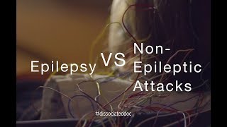 Epilepsy VS NonEpileptic Attacks Misdiagnosis amp Key Differences [upl. by Minette583]