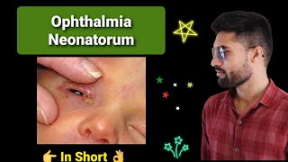 Opthalmia neonatorum lecture opthalmology [upl. by Volpe]