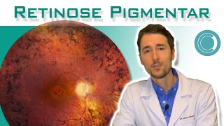 Retinose Pigmentar  sintomas e diagnóstico [upl. by Pederson]