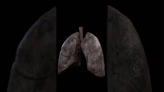 This Is What Happens to Your Lungs When You Smoke [upl. by Oinotna]