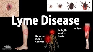 Lyme Disease Animation [upl. by Mastat]