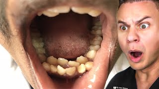 Orthodontist Reacts To The WEIRDEST Teeth On TikTok [upl. by Grassi992]