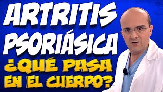 ARTRITIS DE LA PSORIASIS  ¿Qué pasa dentro del cuerpo de las personas que la padecen [upl. by Aham]