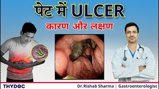 पेट के अल्सर के कारण और लक्षण  Stomach Ulcer Causes amp Symptoms  Peptic Ulcer क्यु है ThyDocHealth [upl. by Ecinad903]