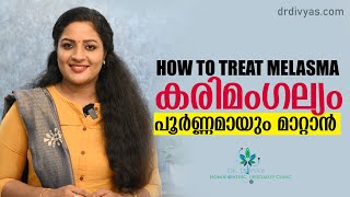 കരിമംഗല്യം പൂർണ്ണമായും മാറ്റാൻ  How To Treat MELASMA  Dark Spots  HYPER PIGMENTATION On Face [upl. by Huber]