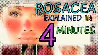 ACNE ROSACEA  ROSACEA EXPLAINED IN 4 MINUTES  TYPES OF ROSACEA  CAUSES  TREATMENT OF ROSACEA [upl. by Naerad542]