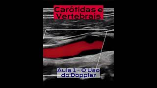 Curso Carótidas e Vertebrais  Tópicos Aula 1 [upl. by Scott]