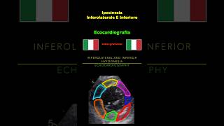 Ecocardiografia  Ipocinesia Inferolaterale E Inferiore [upl. by Ykcir448]