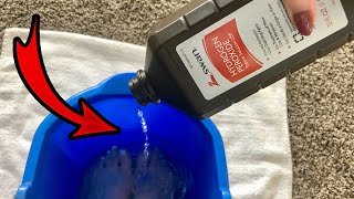 Put Hydrogen Peroxide on your FEET amp SEE WHAT HAPPENS 💥 this is cool and surprising [upl. by Lal]