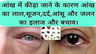 आंख में कीड़ा चला जाए तब करे ये इलाज। eye in insect then take the proper treatment in hospital [upl. by Ramberg119]