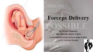 Teaching Forceps Delivery [upl. by Culver]