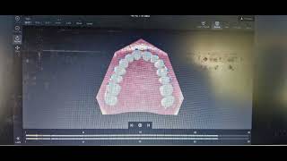 MNR Dental College quotOrthodontics Webinar Mastering Aligner Biomechanics for Precision Treatmentquot [upl. by Antsirhc460]