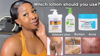 THE BEST BODY LOTIONS FOR UNEVEN SKIN  BODY ACNE  BUMPY SKIN  Fast working lotions‼️ [upl. by Bartolome]