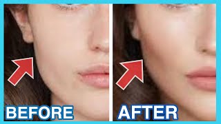 Get High Cheekbones Naturally With This Massage amp Exercise  Beautiful Cheekbones [upl. by Honeywell933]