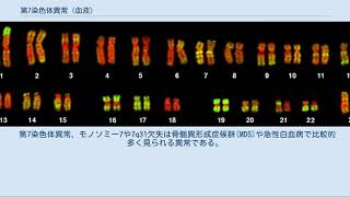 第7染色体異常 血液 [upl. by Akcire548]