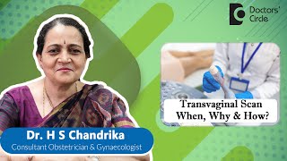 TVS  TRANSVAGINAL SCAN ultrasound womenshealth  Dr H S Chandrika  Doctors Circle [upl. by Kira]