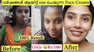 💯Result Best skin Brightening Cream 🧴❌No Side Effects 😎glamyganga [upl. by Acemahs]