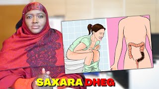 WAA TANAA SABABAHA SAXARADA KUGU DHAGAN TAHAY DAAWO MUUQAALKAAN FAAIDADA BADAN [upl. by Soma]