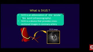 BASIC OF IVUS INTRAVASCULAR ULTRASOUND WITH SLIDES PRESENTATION BY FAMOUS CARDIOLOGISTS [upl. by Asilana815]