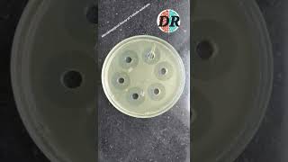 Microbiological Assay of Antibiotics [upl. by Stillman]