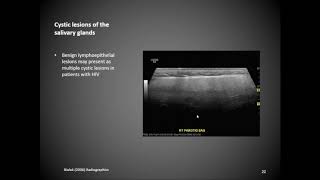 Salivary Glands [upl. by Obadiah909]